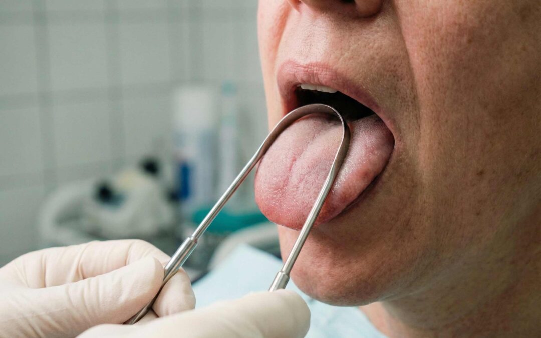 Cómo limpiara la lengua de forma correcta.