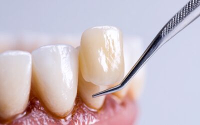 Dentista infantil en Vitoria: la primera visita al dentista sin miedo