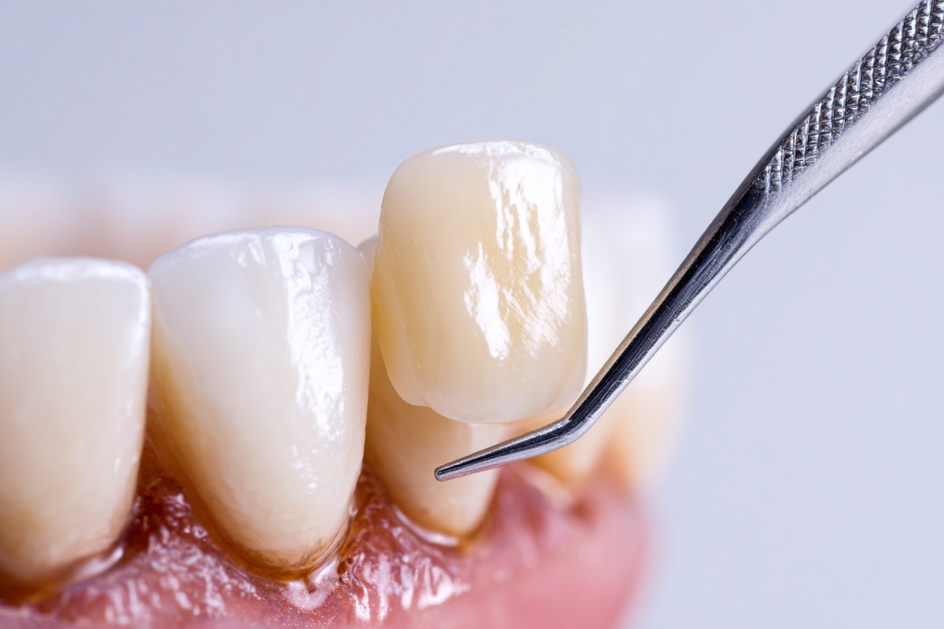 Dentista infantil en Vitoria - Clínica Lakudent